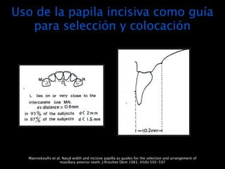 Uso de la papila incisiva como guía
   para selección y colocación




  Mavroskouﬁs et al. Nasal width and incisive papilla as guides for the selection and arrangement of
                   maxillary anterior teeth. J Prosthet Dent 1981; 45(6):592-597
 