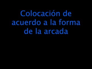 Colocación de
acuerdo a la forma
   de la arcada
 
