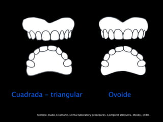 Cuadrada - triangular                                       Ovoide

       Morrow, Rudd, Eissmann. Dental laboratory procedures. Complete Dentures. Mosby, 1980.
 