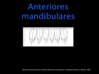 Anteriores
mandibulares




Morrow, Rudd, Eissmann. Dental laboratory procedures. Complete Dentures. Mosby, 1980.
 