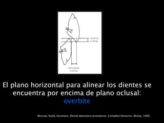El plano horizontal para alinear los dientes se
    encuentra por encima de plano oclusal:
                   overbite

           Morrow, Rudd, Eissmann. Dental laboratory procedures. Complete Dentures. Mosby, 1980.
 