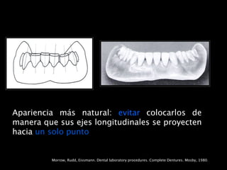 Apariencia más natural: evitar colocarlos de
manera que sus ejes longitudinales se proyecten
hacia un solo punto


         Morrow, Rudd, Eissmann. Dental laboratory procedures. Complete Dentures. Mosby, 1980.
 