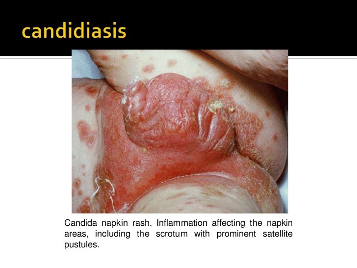 Selected human infectious diseases part 2