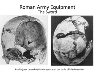 Roman Army Equipment
The Sword
Fatal injures caused by Roman swords on the skulls of killed enemies
 