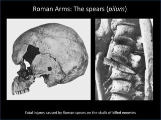 Roman Arms: The spears (pilum)
Fatal injures caused by Roman spears on the skulls of killed enemies
 