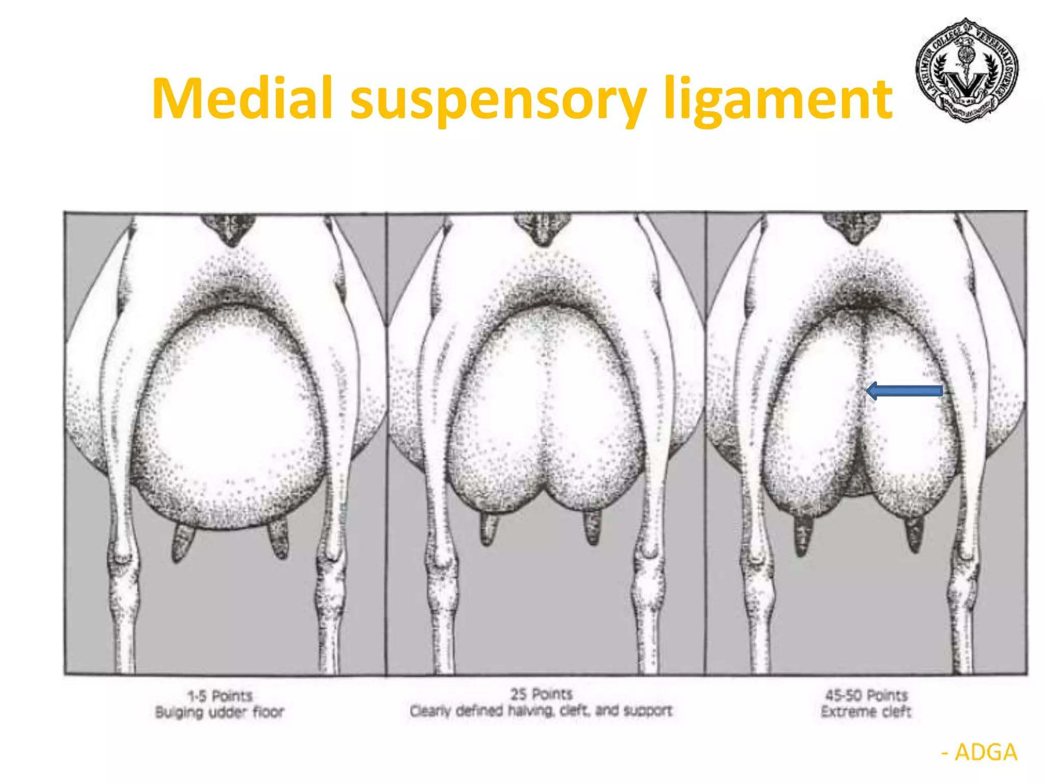 Medial suspensory ligament
 