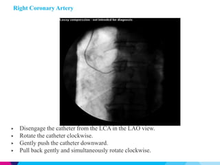 Kwan TW - AIMRADIAL 2014 Technical - Selection of catheters | PPTX