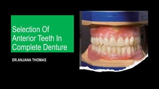 Selection Of
Anterior Teeth In
Complete Denture
DR.ANJANA THOMAS
 