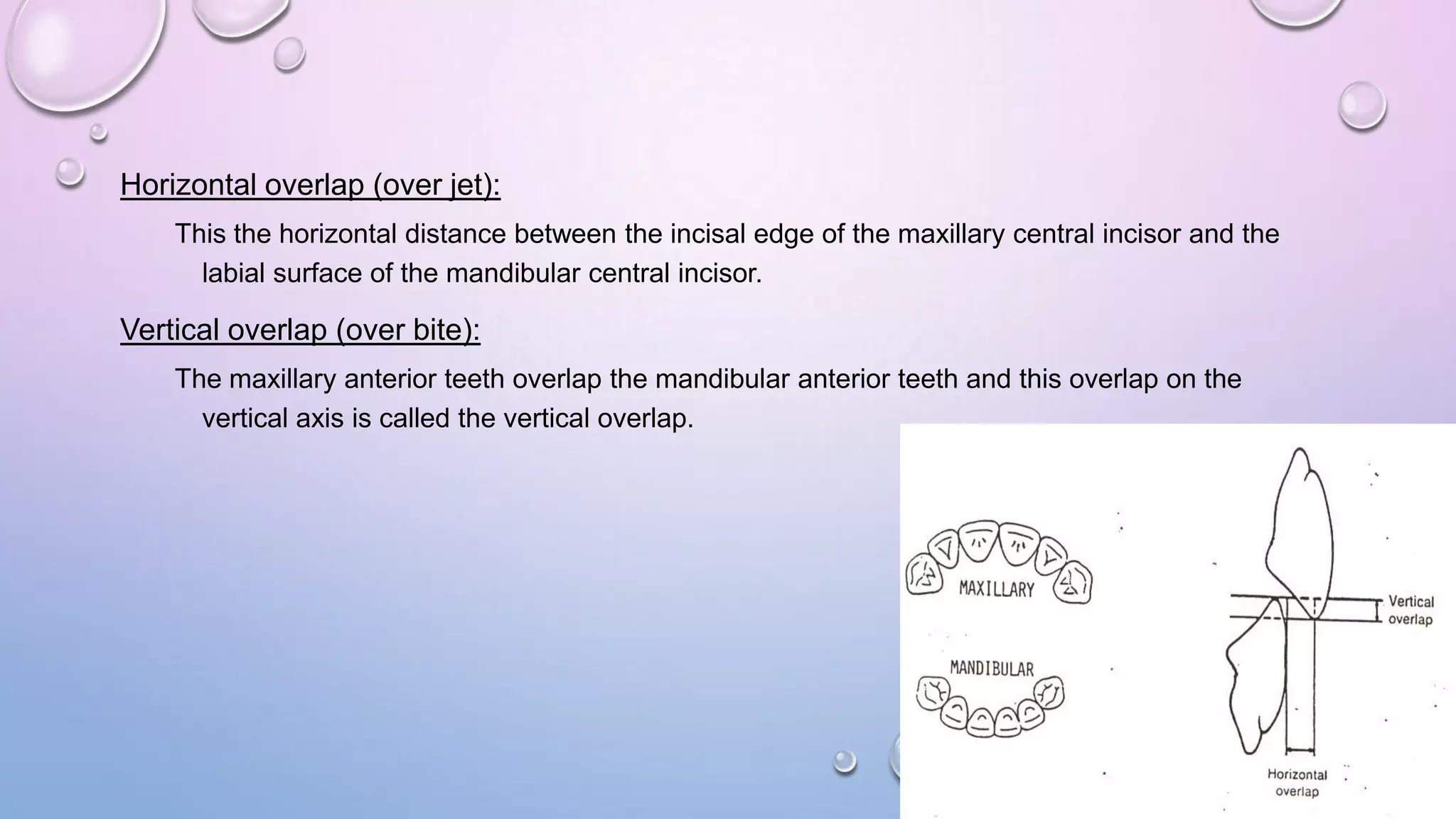 Horizontal overlap (over jet):
This the horizontal distance between the incisal edge of the maxillary central incisor and the
labial surface of the mandibular central incisor.

Vertical overlap (over bite):
The maxillary anterior teeth overlap the mandibular anterior teeth and this overlap on the
vertical axis is called the vertical overlap.

 