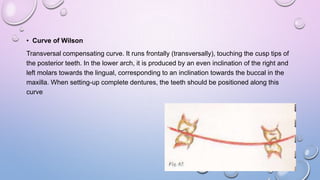 • Curve of Wilson
Transversal compensating curve. It runs frontally (transversally), touching the cusp tips of
the posterior teeth. In the lower arch, it is produced by an even inclination of the right and
left molars towards the lingual, corresponding to an inclination towards the buccal in the
maxilla. When setting-up complete dentures, the teeth should be positioned along this
curve

 