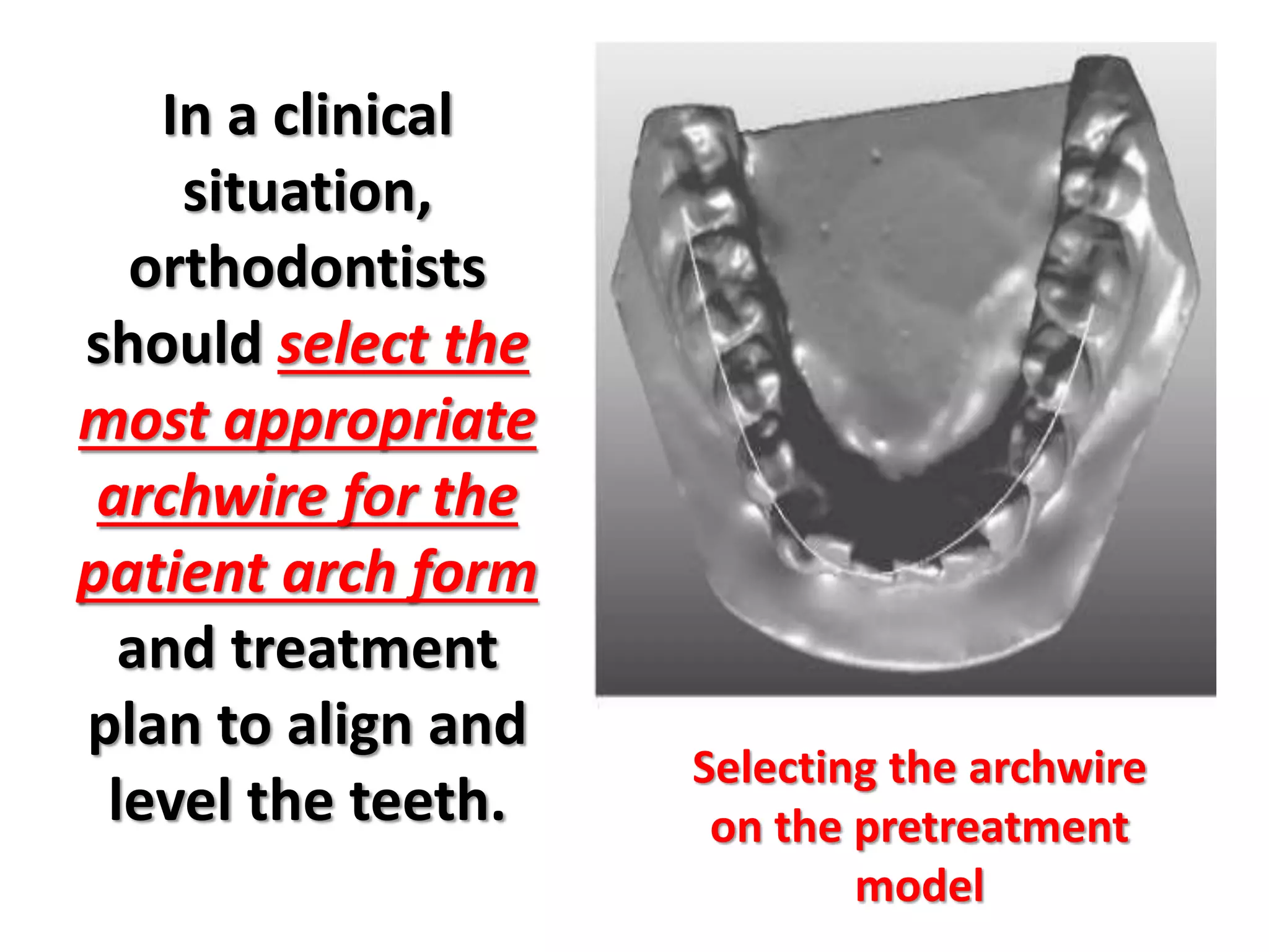In a clinical
situation,
orthodontists
should select the
most appropriate
archwire for the
patient arch form
and treatment
plan to align and
level the teeth.
Selecting the archwire
on the pretreatment
model
 