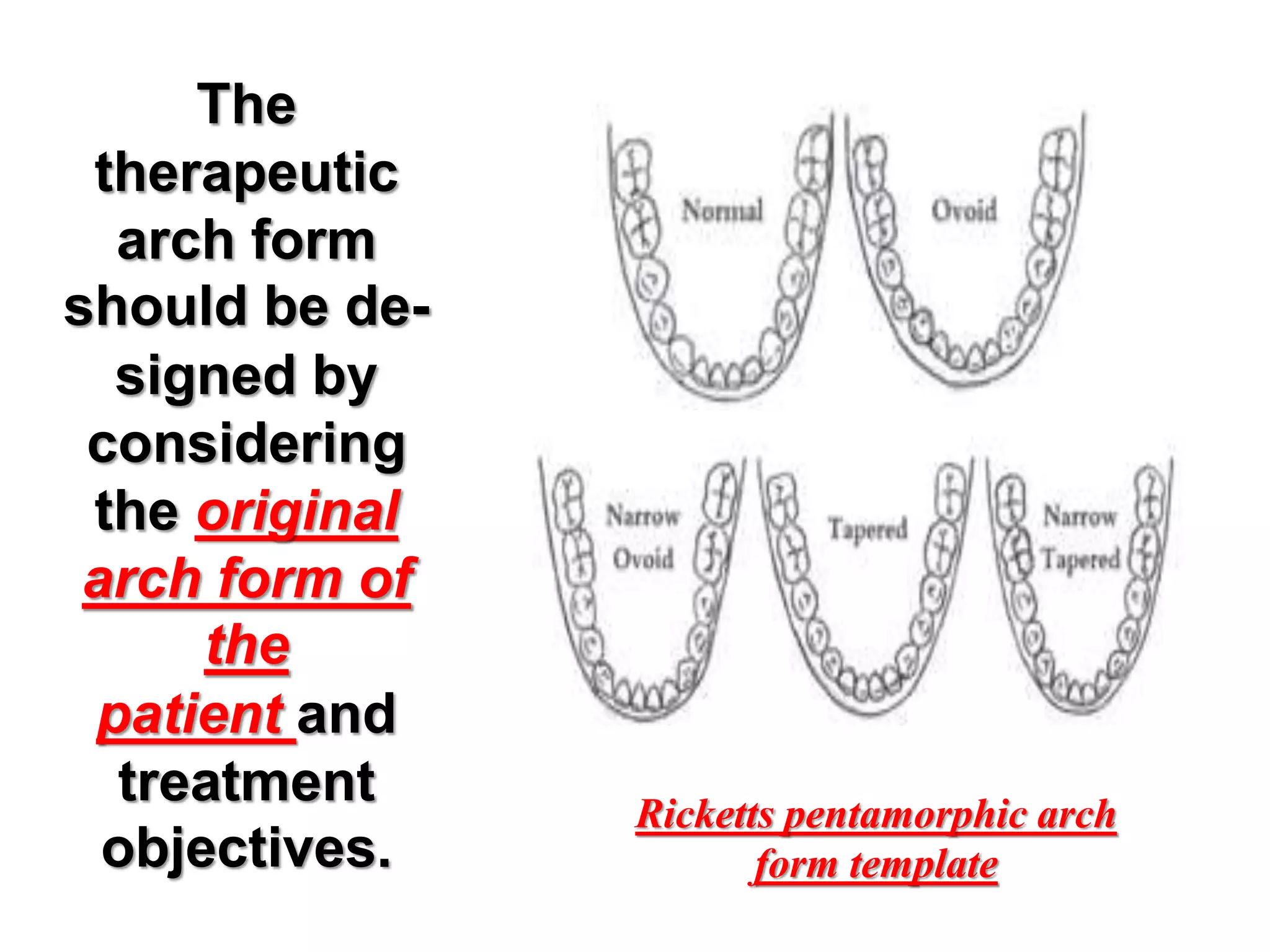 The
therapeutic
arch form
should be de-
signed by
considering
the original
arch form of
the
patient and
treatment
objectives.
Ricketts pentamorphic arch
form template
 