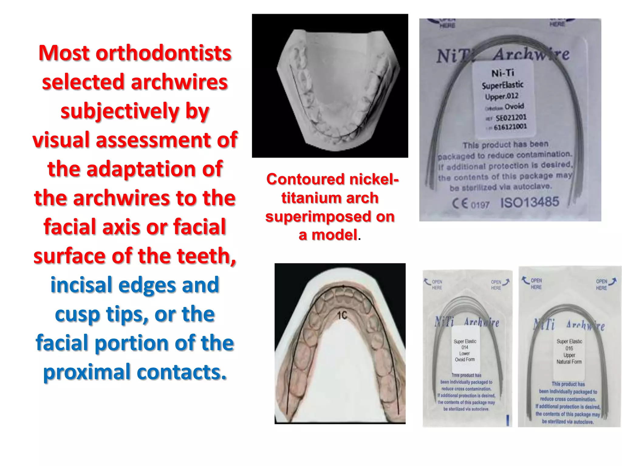 Most orthodontists
selected archwires
subjectively by
visual assessment of
the adaptation of
the archwires to the
facial axis or facial
surface of the teeth,
incisal edges and
cusp tips, or the
facial portion of the
proximal contacts.
Contoured nickel-
titanium arch
superimposed on
a model.
 
