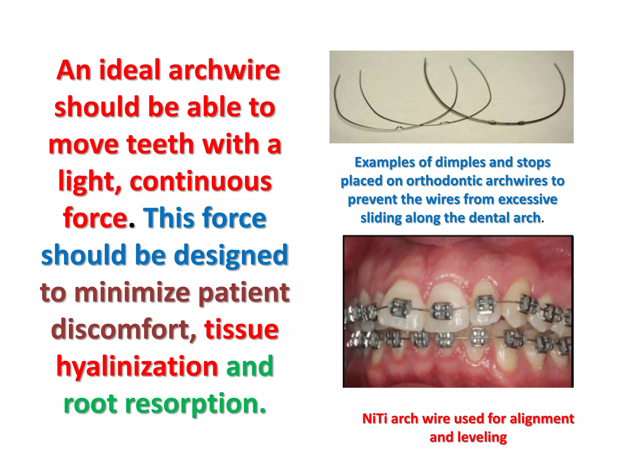 An ideal archwire
should be able to
move teeth with a
light, continuous
force. This force
should be designed
to minimize patient
discomfort, tissue
hyalinization and
root resorption.
Examples of dimples and stops
placed on orthodontic archwires to
prevent the wires from excessive
sliding along the dental arch.
NiTi arch wire used for alignment
and leveling
 