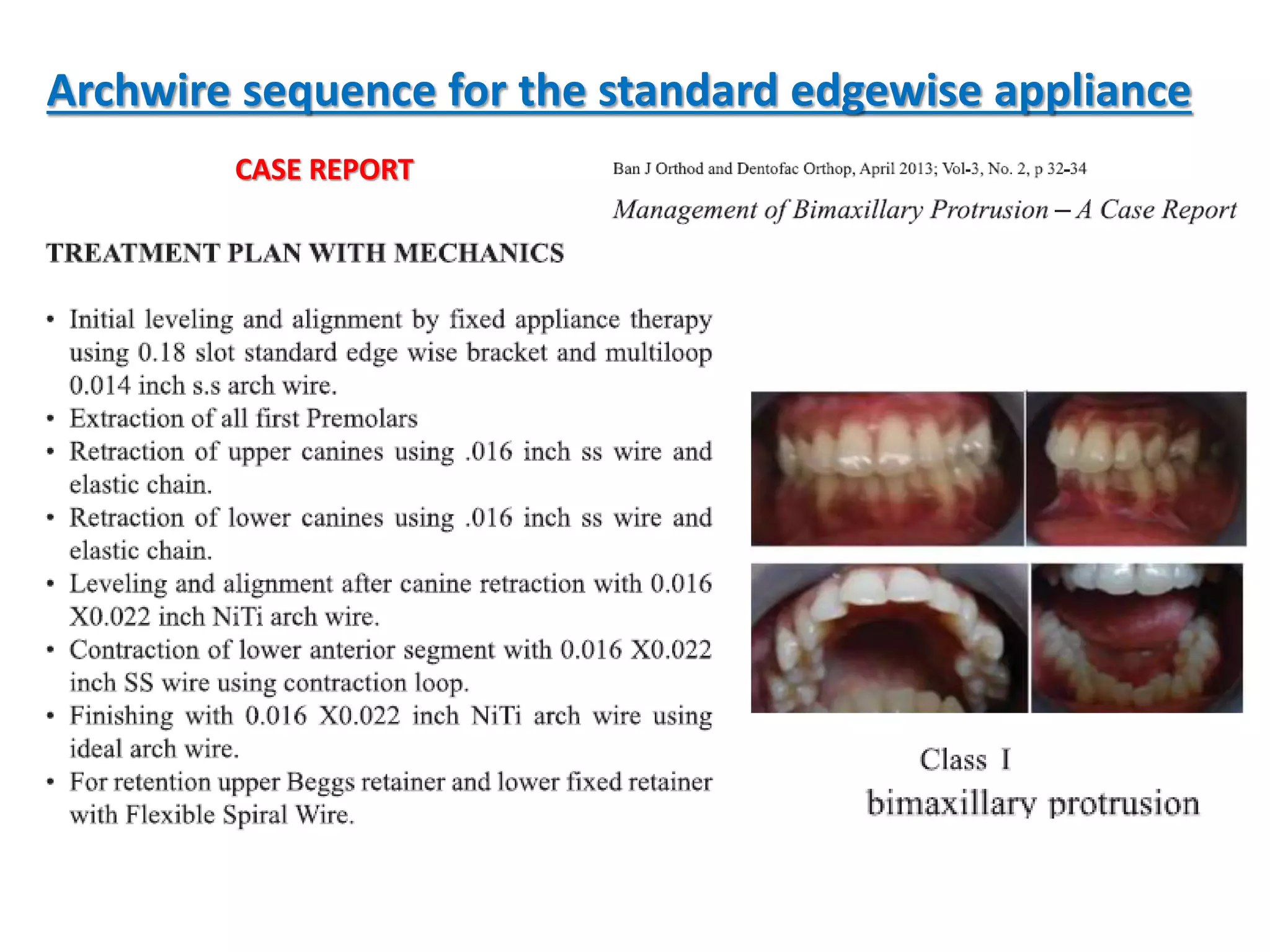 Archwire sequence for the standard edgewise appliance
CASE REPORT
 