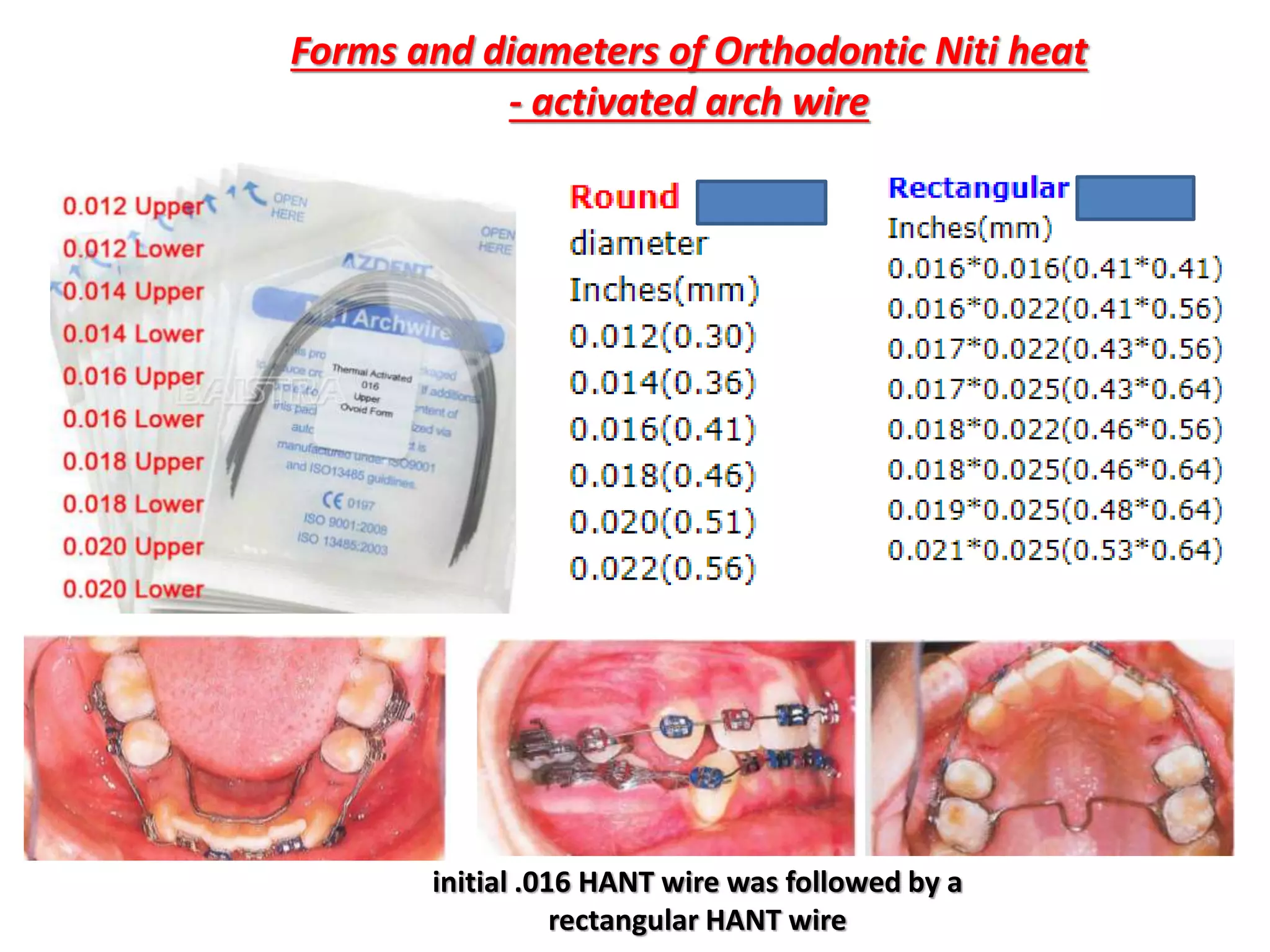 Forms and diameters of Orthodontic Niti heat
- activated arch wire
initial .016 HANT wire was followed by a
rectangular HANT wire
 