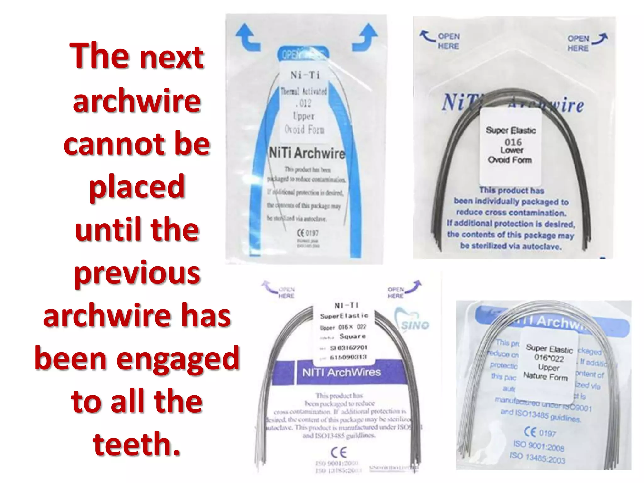 The next
archwire
cannot be
placed
until the
previous
archwire has
been engaged
to all the
teeth.
 