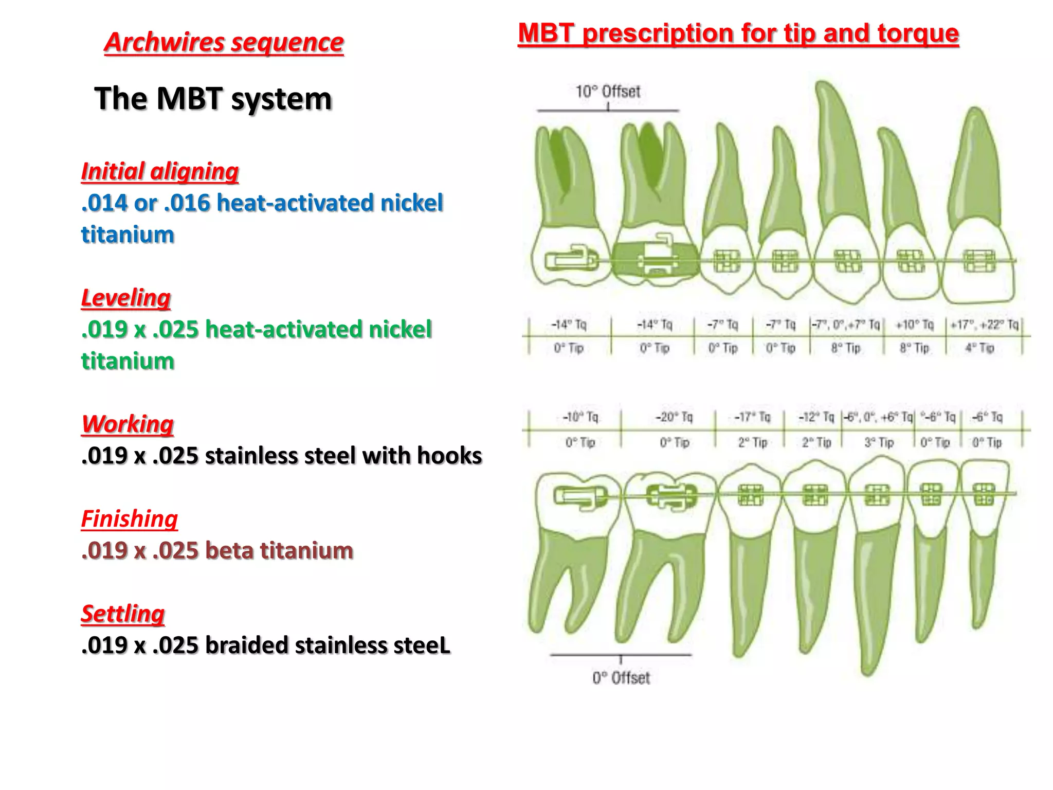 MBT prescription for tip and torque
Archwires sequence
The MBT system
Initial aligning
.014 or .016 heat-activated nickel
titanium
Leveling
.019 x .025 heat-activated nickel
titanium
Working
.019 x .025 stainless steel with hooks
Finishing
.019 x .025 beta titanium
Settling
.019 x .025 braided stainless steeL
 