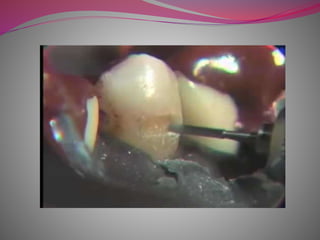 selection_of_proper_restorative_material.pptx