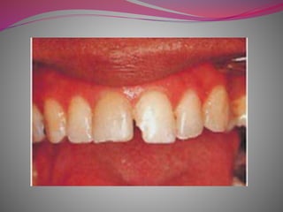 selection_of_proper_restorative_material.pptx