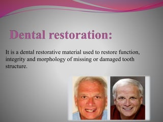 It is a dental restorative material used to restore function,
integrity and morphology of missing or damaged tooth
structure.
 