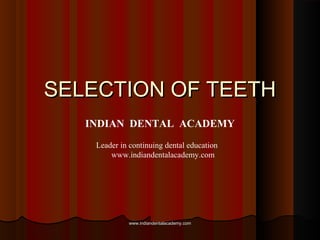 SELECTION OF TEETHSELECTION OF TEETH
INDIAN DENTAL ACADEMY
Leader in continuing dental education
www.indiandentalacademy.com
www.indiandentalacademy.comwww.indiandentalacademy.com
 