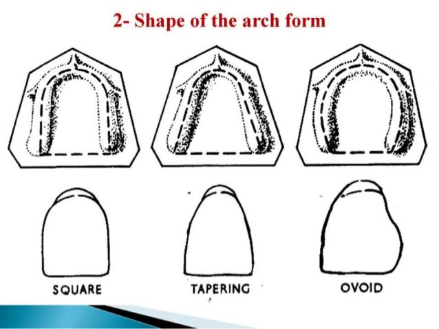 selection of teeth 2nd year 2014 arch form