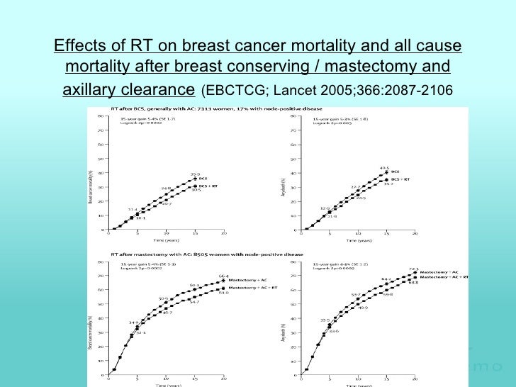 Selective Use Of Postoperative Radiotherapy AftEr MastectOmy