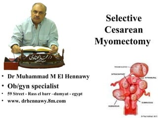 Selective
Cesarean
Myomectomy
• Dr Muhammad M El Hennawy
• Ob/gyn specialist
• 59 Street - Rass el barr –dumyat - egypt
• www. drhennawy.8m.com
 