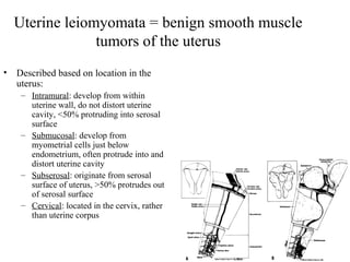 Selective cesarean myomectomy | PPT
