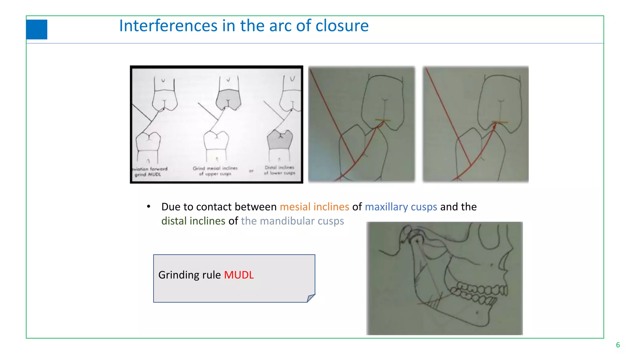 • Due to contact between mesial inclines of maxillary cusps and the
distal inclines of the mandibular cusps
Grinding rule MUDL
6
Interferences in the arc of closure
 