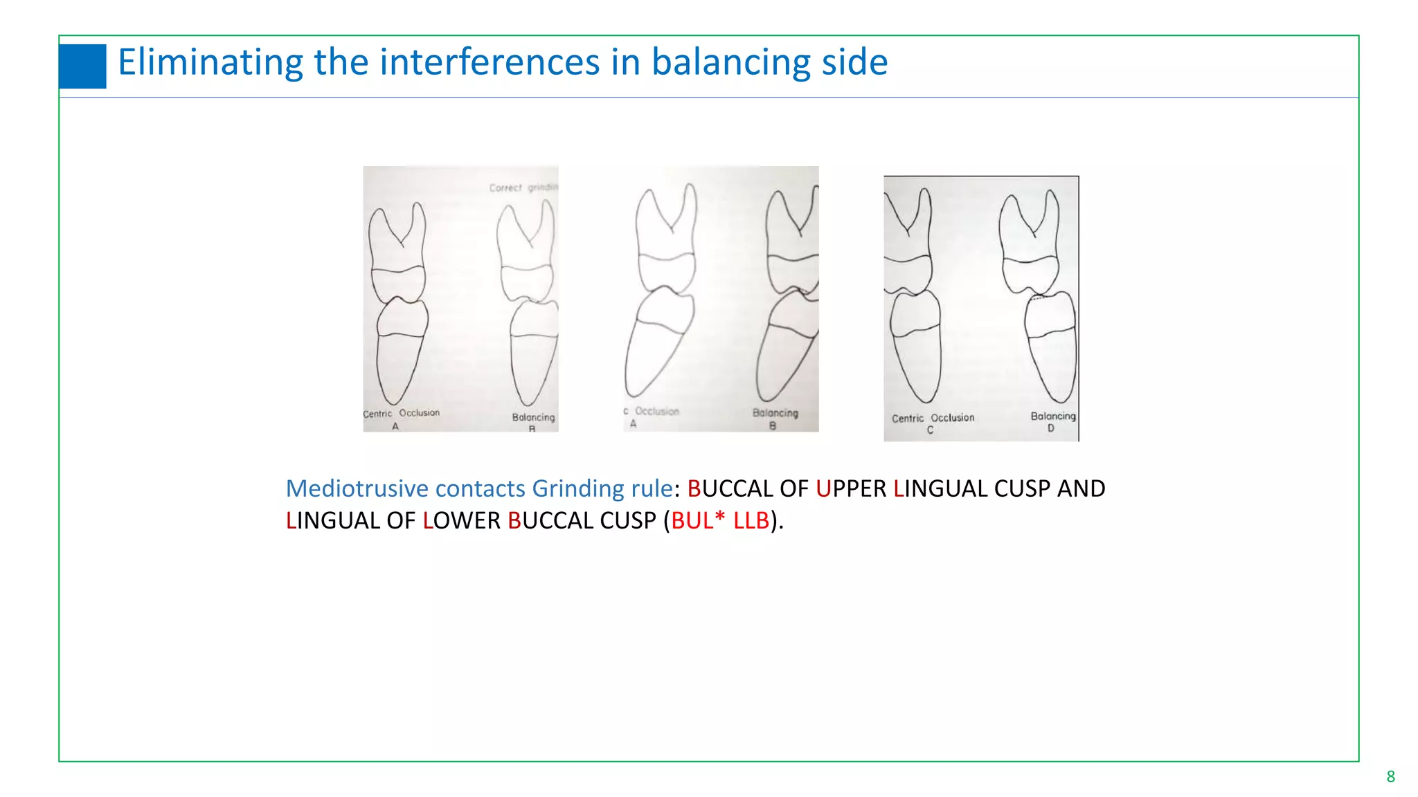 Mediotrusive contacts Grinding rule: BUCCAL OF UPPER LINGUAL CUSP AND
LINGUAL OF LOWER BUCCAL CUSP (BUL* LLB).
8
Eliminating the interferences in balancing side
 