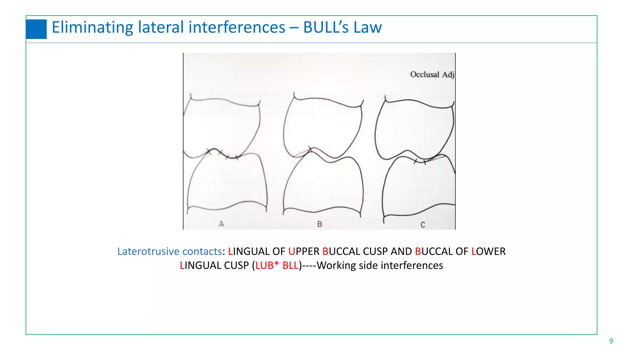 Laterotrusive contacts: LINGUAL OF UPPER BUCCAL CUSP AND BUCCAL OF LOWER
LINGUAL CUSP (LUB* BLL)----Working side interferences
9
Eliminating lateral interferences – BULL’s Law
 
