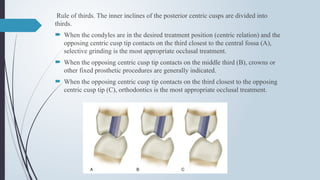 Rule of thirds. The inner inclines of the posterior centric cusps are divided into
thirds.
 When the condyles are in the desired treatment position (centric relation) and the
opposing centric cusp tip contacts on the third closest to the central fossa (A),
selective grinding is the most appropriate occlusal treatment.
 When the opposing centric cusp tip contacts on the middle third (B), crowns or
other fixed prosthetic procedures are generally indicated.
 When the opposing centric cusp tip contacts on the third closest to the opposing
centric cusp tip (C), orthodontics is the most appropriate occlusal treatment.
 