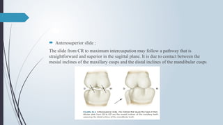  Anterosuperior slide :
The slide from CR to maximum intercuspation may follow a pathway that is
straightforward and superior in the sagittal plane. It is due to contact between the
mesial inclines of the maxillary cusps and the distal inclines of the mandibular cusps
 