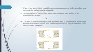  When a right lateral slide is created by opposing tooth contacts on the left side of the arch,
two contacting surfaces may be responsible:
 the inner inclines of the maxillary buccal cusps against the outer inclines of the
mandibular buccal cusps
OR
 The outer of the maxillary lingual cusps against the inner of the mandibular lingual cusps.
Since these inclines are also the areas for laterotrusive contacts, they are sometimes called
laterotrusive CR interferenc
 