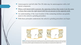  Anterosuperior and left slide The CR slide may be anterosuperior with a left
lateral component.
 When a left lateral shift is present, the opposing inclines that create it are the same
as those that create the right lateral shift but are present on the opposite teeth
 An understanding of the exact location of the contacting inclines can greatly
assist in the selective grinding procedure.
 With these principles understood, the selective grinding procedure can begin.
 