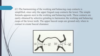 (C) The harmonizing of the working and balancing cusp contacts is
simplified, since only the upper lingual cusp contacts the lower. The simple
formula appears next to the working and balancing teeth. These contacts are
easily obtained by selective grinding to harmonize the working and balancing
cusps of the lower teeth. The upper buccal cusps are ground only when in
contact to create buccal clearance
 