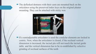  The deflasked dentures with their casts are mounted back on the
articulator using the preserved index keys on the original plaster
mounting. They can be attached with sticky wax
 If a semiadjustable articulator is used the condylar elements are locked in
centric. Now, when the articulator is closed, if the occlusal vertical
dimension is increased, the incisal pin will not touch the incisal guide
table and the vertical dimension has to be re-established by selective
grinding of occlusal surfaces of the teeth
 