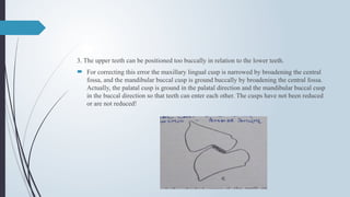 3. The upper teeth can be positioned too buccally in relation to the lower teeth.
 For correcting this error the maxillary lingual cusp is narrowed by broadening the central
fossa, and the mandibular buccal cusp is ground buccally by broadening the central fossa.
Actually, the palatal cusp is ground in the palatal direction and the mandibular buccal cusp
in the buccal direction so that teeth can enter each other. The cusps have not been reduced
or are not reduced!
 