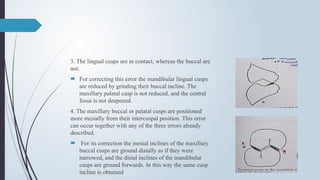 3. The lingual cusps are in contact, whereas the buccal are
not.
 For correcting this error the mandibular lingual cusps
are reduced by grinding their buccal incline. The
maxillary palatal cusp is not reduced, and the central
fossa is not deepened.
4. The maxillary buccal or palatal cusps are positioned
more mesially from their intercuspal position. This error
can occur together with any of the three errors already
described.
 For its correction the mesial inclines of the maxillary
buccal cusps are ground distally as if they were
narrowed, and the distal inclines of the mandibular
cusps are ground forwards. In this way the same cusp
incline is obtained
 