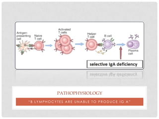 PATHOPHYSIOLOGY
“B LYMPHOCYTES ARE UNABLE TO PRODUCE IG A”
 