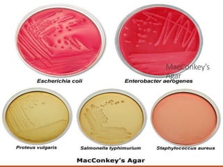 MacConkey’s
Agar
 