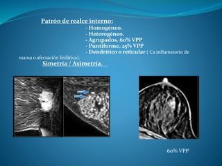 Patrón de realce interno:
- Homogéneo.
- Heterogéneo.
- Agrupados. 60% VPP
- Puntiforme. 25% VPP
- Dendrítico o reticular ( Ca inflamatorio de
mama o afectación linfática).
Simetría / Asimetría.
60% VPP
 