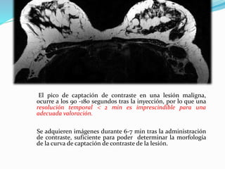 El pico de captación de contraste en una lesión maligna,
ocurre a los 90 -180 segundos tras la inyección, por lo que una
resolución temporal  2 min es imprescindible para una
adecuada valoración.
Se adquieren imágenes durante 6-7 min tras la administración
de contraste, suficiente para poder determinar la morfología
de la curva de captación de contraste de la lesión.
 