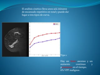Tipo 1
Hay un lento ascenso y un
aumento continuo y
persistente en el tiempo.
6% VPP malignos .
El análisis cinético lleva unos seis minutos
de escaneado repetitivo en total y puede dar
lugar a tres tipos de curva.
 