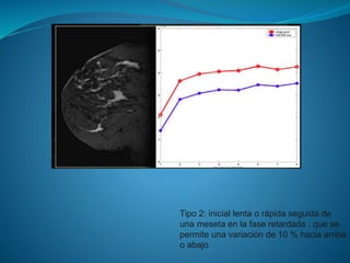 Tipo 2: inicial lenta o rápida seguida de
una meseta en la fase retardada , que se
permite una variación de 10 % hacia arriba
o abajo
 