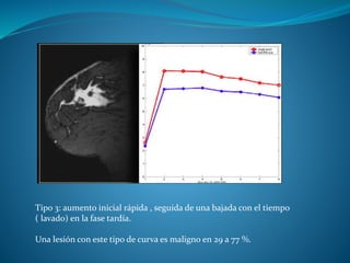 Tipo 3: aumento inicial rápida , seguida de una bajada con el tiempo
( lavado) en la fase tardía.
Una lesión con este tipo de curva es maligno en 29 a 77 %.
 