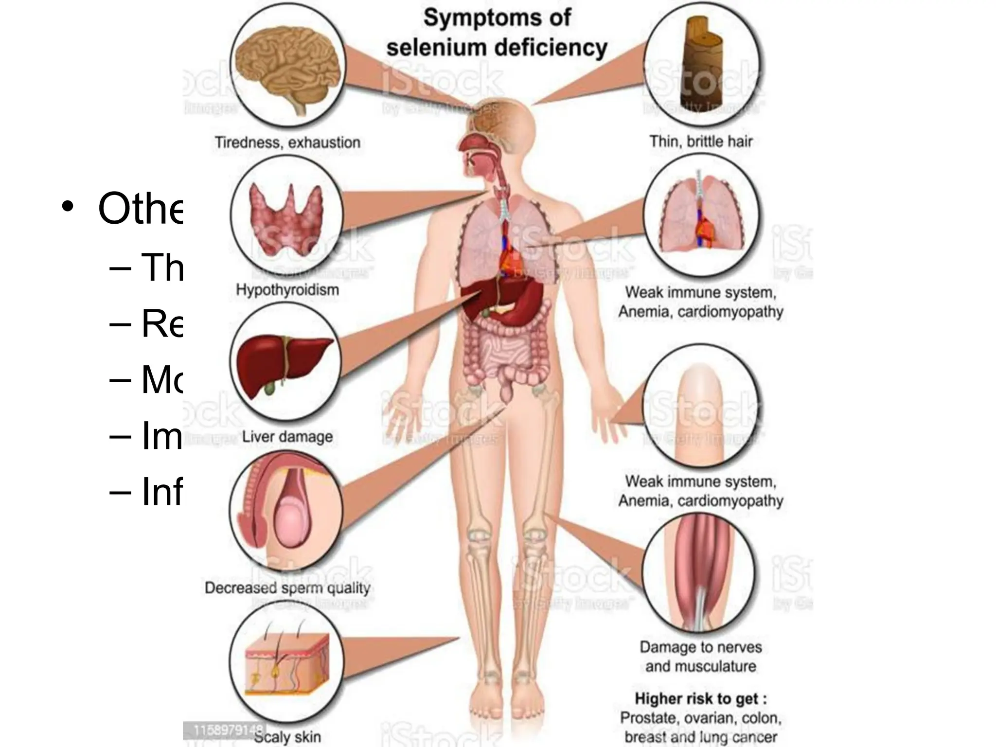 • Other deficiency effects
– Thyroid function
– Reproductive disorders
– Mood disorders
– Immune functions
– Infections cause deficiency
 