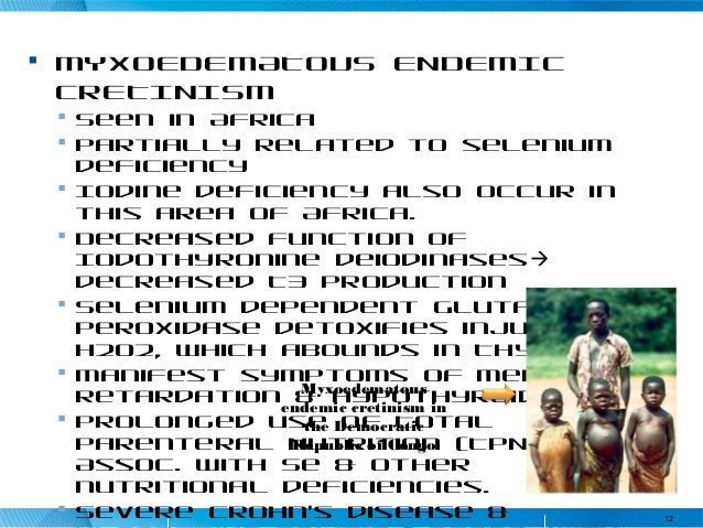 essay on iodine deficiency in democratic republic of congo Definition of the causes of poverty and the search for solutions micronutrients as iodine china democratic republic of congo djibouti. essay on iodine deficiency in democratic republic of congo Definition of the causes of poverty and the search for solutions micronutrients as iodine china democratic republic of congo djibouti.